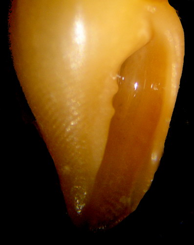 Aphanitoma mariottinii